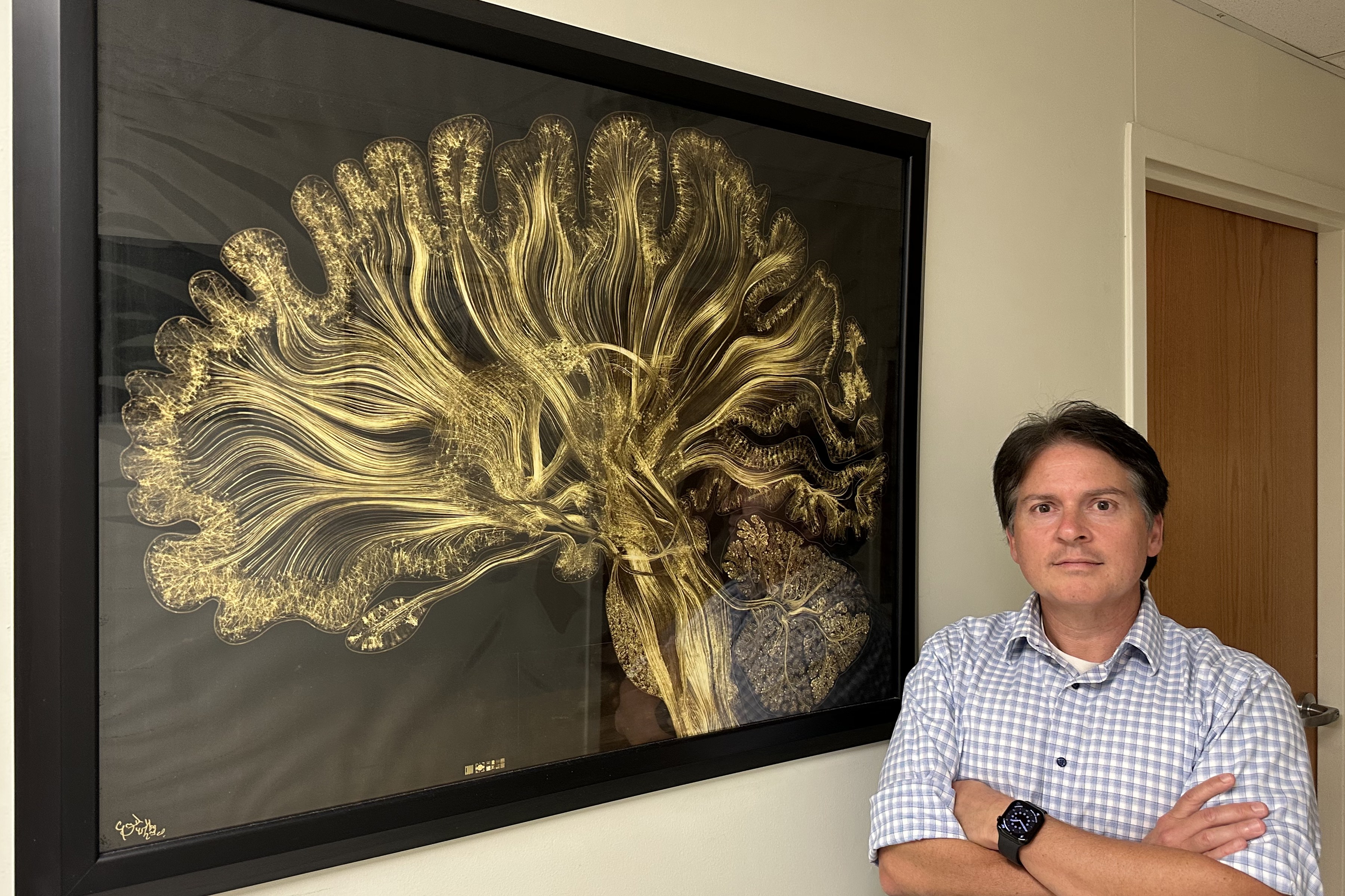 Kacy Cullen with a framed image of lab-grown brain cells.