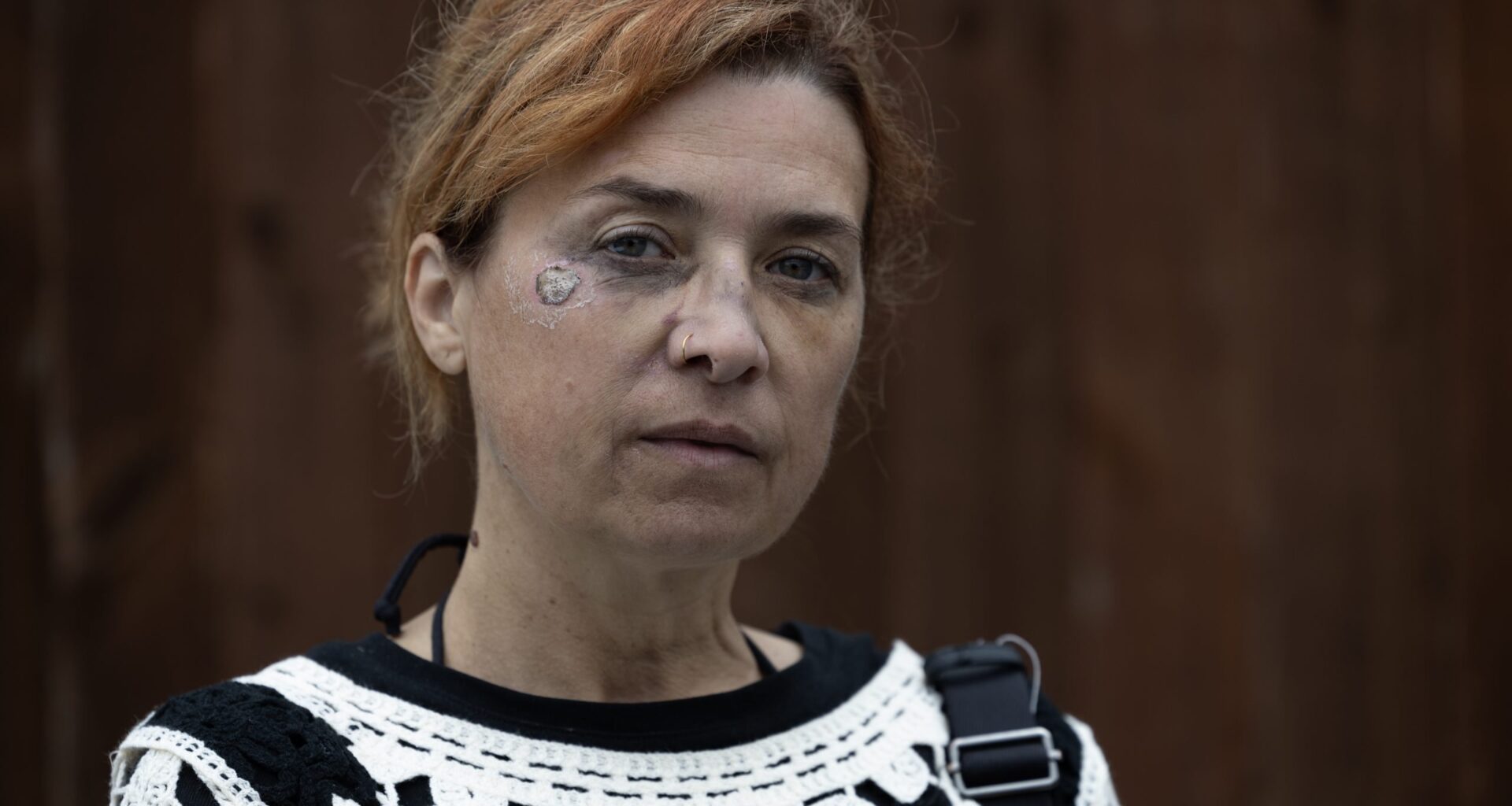 Woman calls for compensation after tripping on council bin foundation in West London