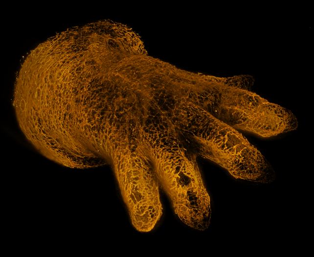 Finger-like protrusions extend from a round ball of cells, stained orange. 