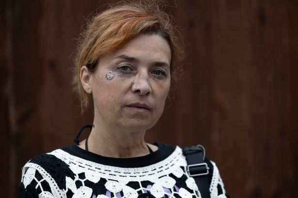 Isabel Guerreiro tripped on Lansbury Avenue, suffering injuries to her face