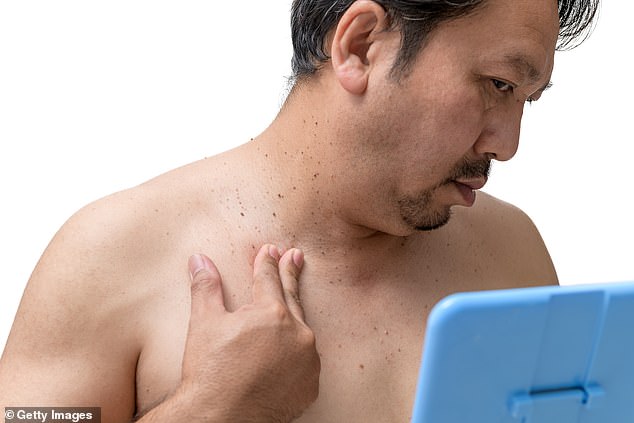 Ever had a skin-coloured growth that appears to have come from nowhere pop up? It’s likely to be a skin tag - or to give it its proper name, an acrochordon