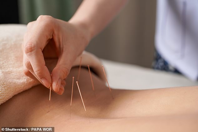 Acupuncture, although not recommended by the NHS for sciatica, has helped some sufferers