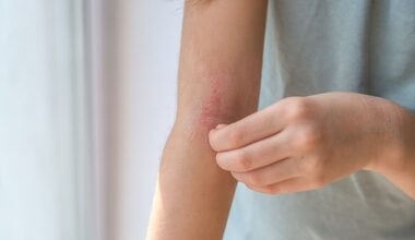 Many people suffer with itchy skin in colder weather.