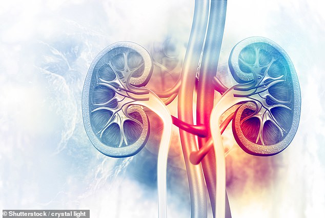 Kidney stones are hard objects made of minerals and salts in urine