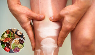 World Arthritis day