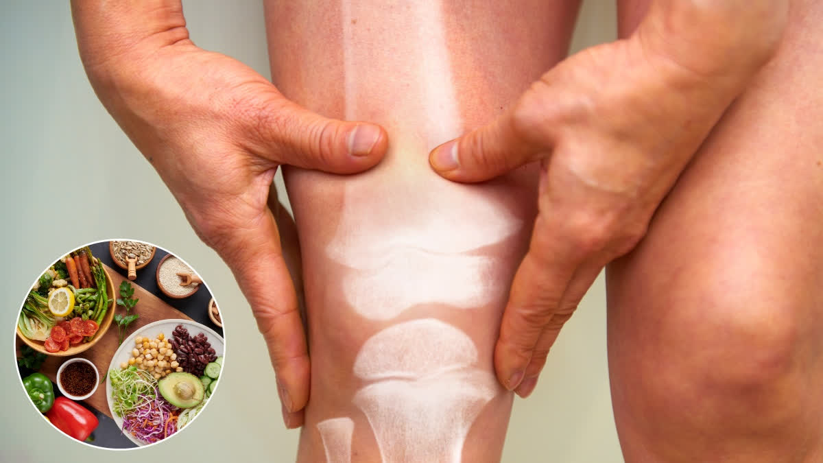World Arthritis day