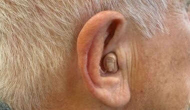 My hearing aids have changed my life