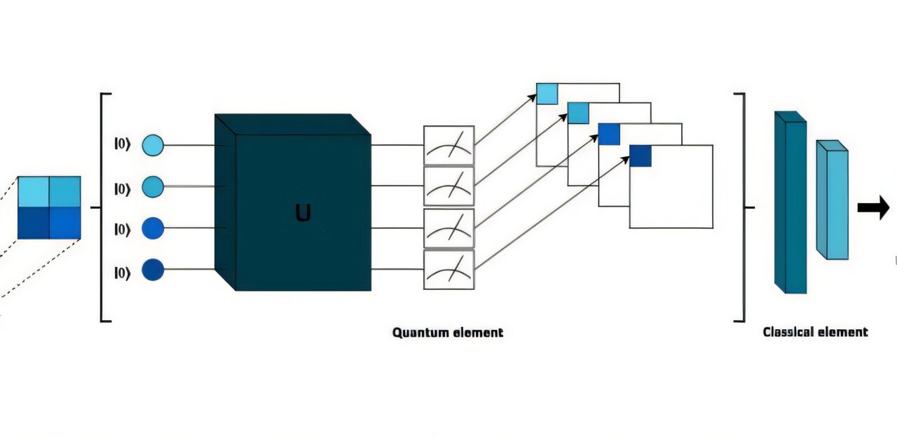 Combination of quantum and classical computing supports early diagnosis of breast cancer