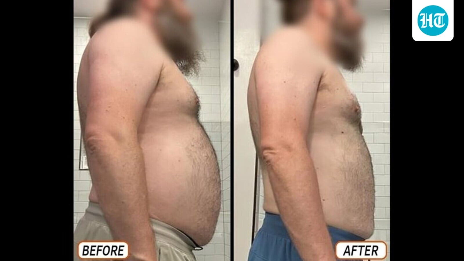 Man loses 20 kg, 6.5 inches off his waist in 90 days without cardio: ‘No snacking, eating 3 hours before bed’