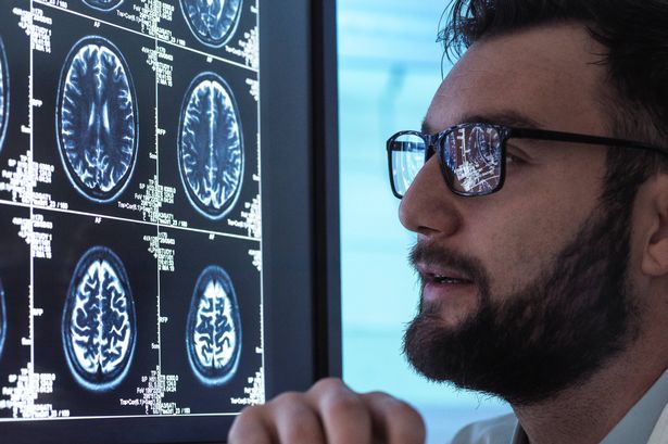Doctor looks at brain scan results