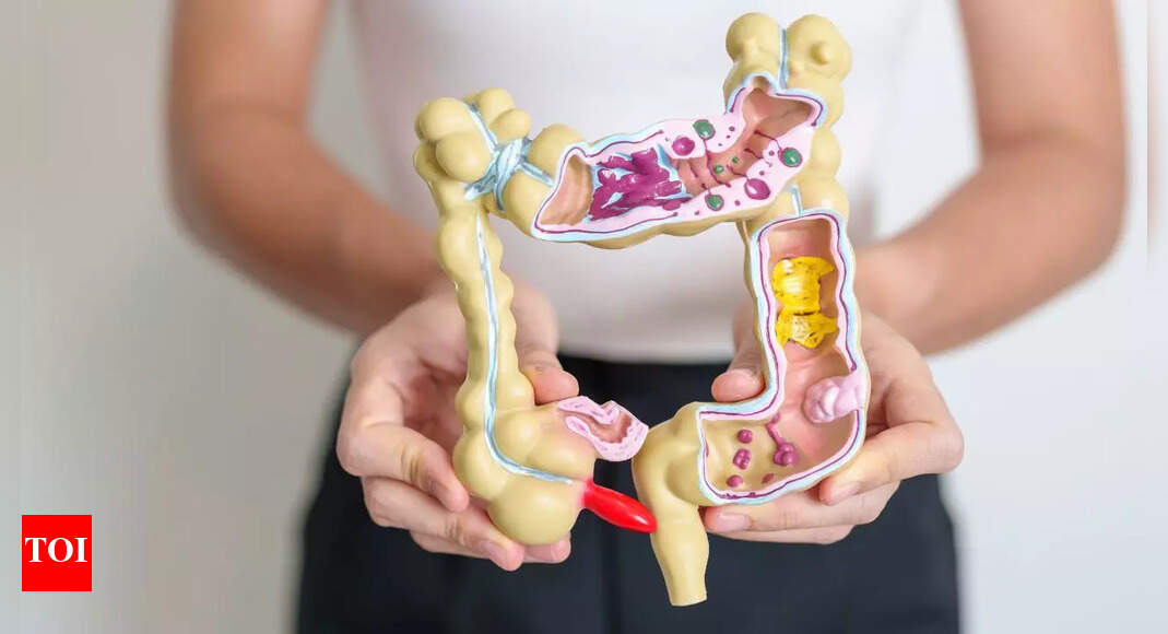 How your morning breakfast could protect you from colon cancer |