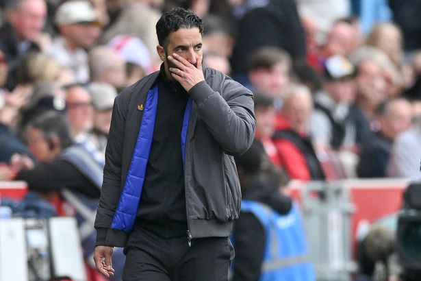 Ruben Amorim puts his hand over his mouth