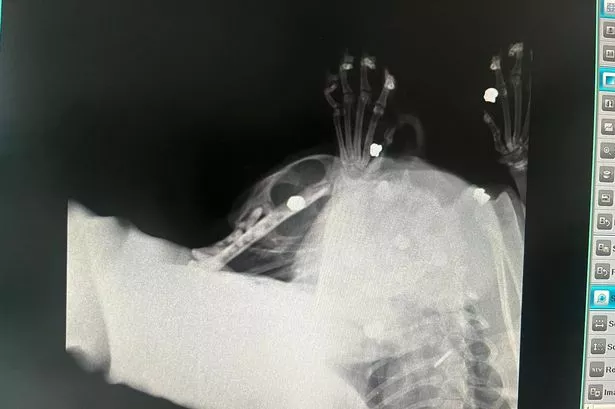 Marley was shot eight times in Salford