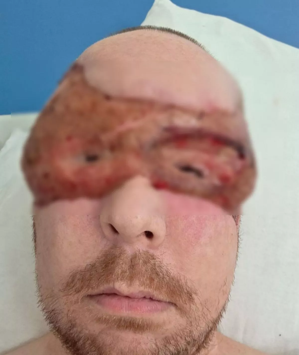 Jack has undergone multiple surgeries to keep him alive.
