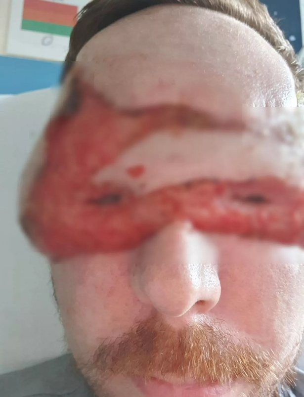 Jack is in hospital.
