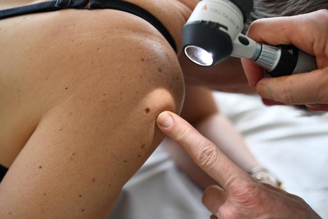 A dermatologist examines a patient's moles in Quimper, western France, on May 22, 2019.