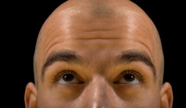 What you eat and drink can contribute to your hair loss