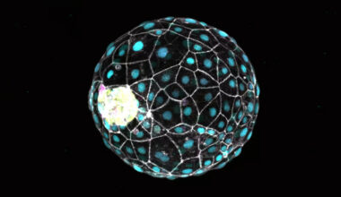 An Ancient Infection May Play a Critical Role in Our First Moments of Life : ScienceAlert