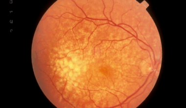 October: Cirrus Therapeutics funding | News and features
