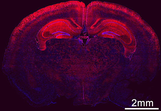 Widespread of transfected cells in the brain by in utero delivery Cre mRNA