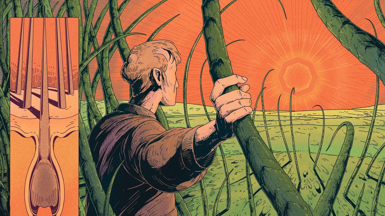 A Finasteride Nightmare: Inside the Dark Side of the Hair-Loss Drug