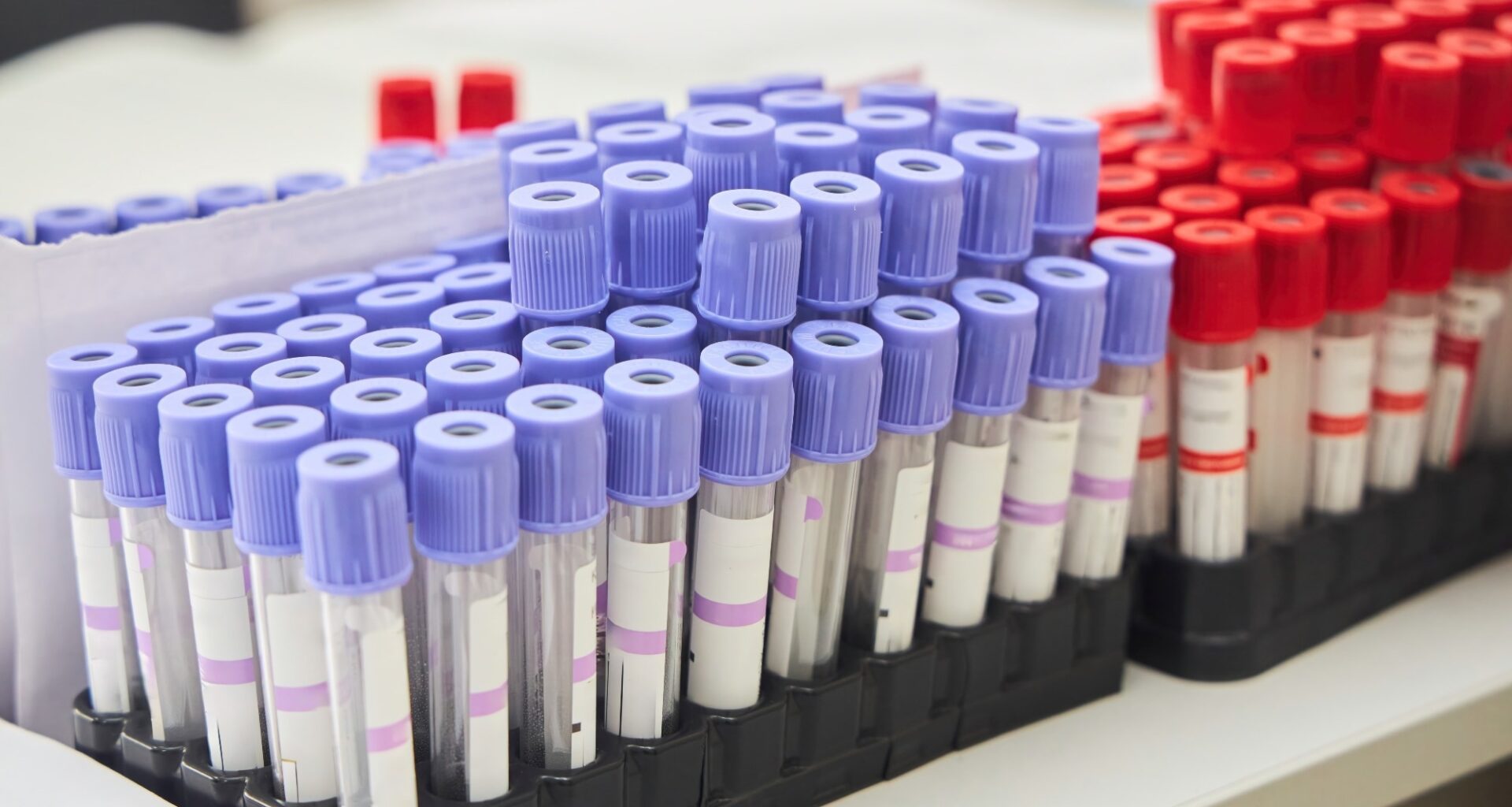 flasks for blood analysis