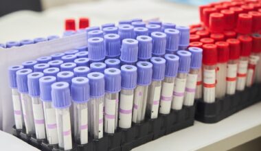 flasks for blood analysis