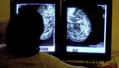 ‘Scandalous’ waiting times for cancer treatment condemned – The Irish News