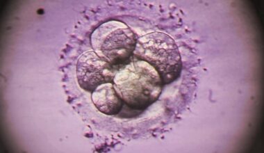 Common IVF test misses some genetic abnormalities in embryos