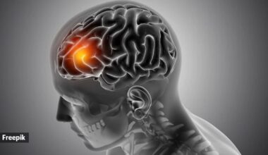 brain strokes
