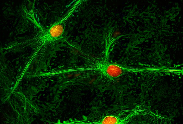 Micrograph of nerve cells, known as neurons, shown as long threads around an oval center.
