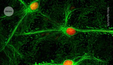 Brain area linked to chronic pain discovered — offering hope for treatments