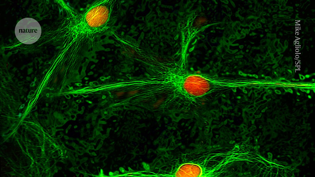 Brain area linked to chronic pain discovered — offering hope for treatments