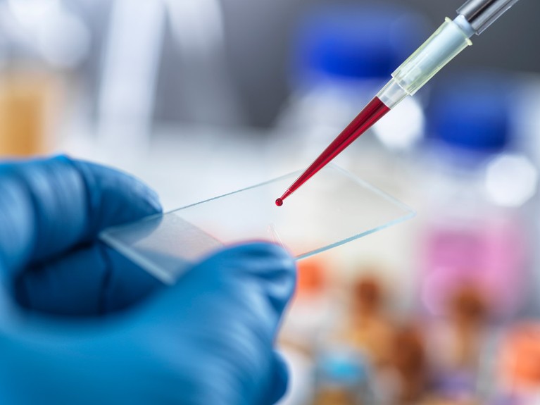 Scientist placing a human blood sample onto a microscope slide.