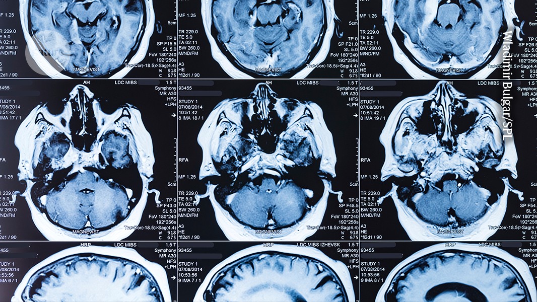breakthroughs that show why fundamental research must be protected