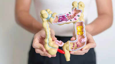 How your morning breakfast could protect you from colon cancer