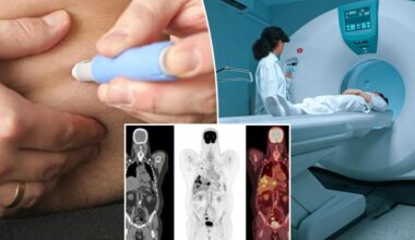 New 'unusual' side effect of GLP-1 drugs like Ozempic on the rise