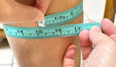 Good diet, exercise, sun exposure urged to avoid sarcopenia