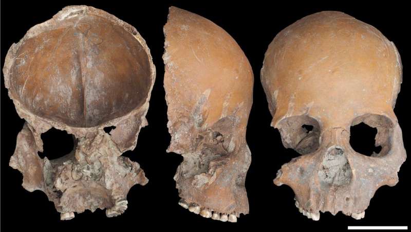 Study analyzes only known neolithic chinese culture to modify human bones