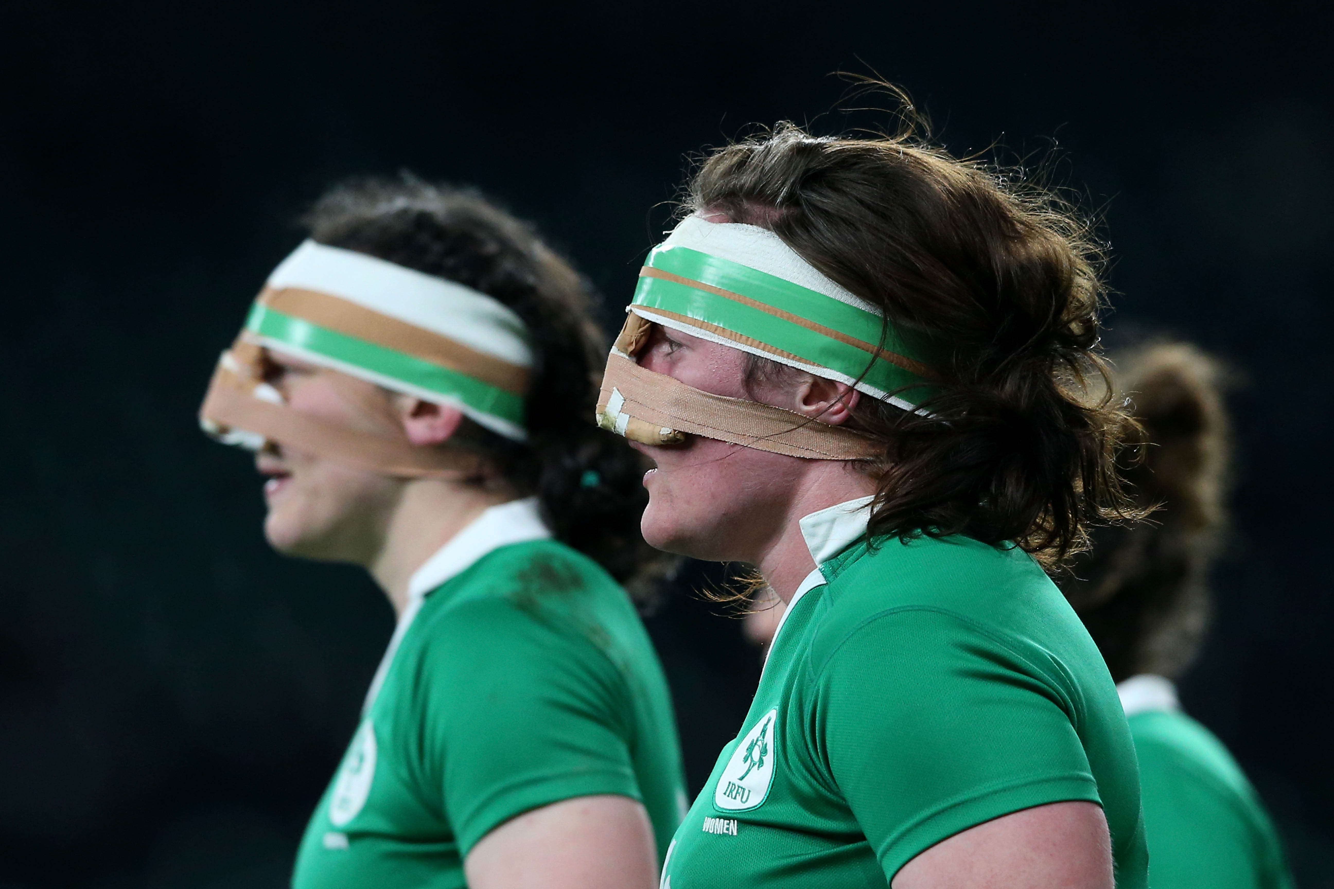 Paula Fitzpatrick and Ailis Egan of Ireland wearing protective tape on their noses during a Women's Six Nations match.