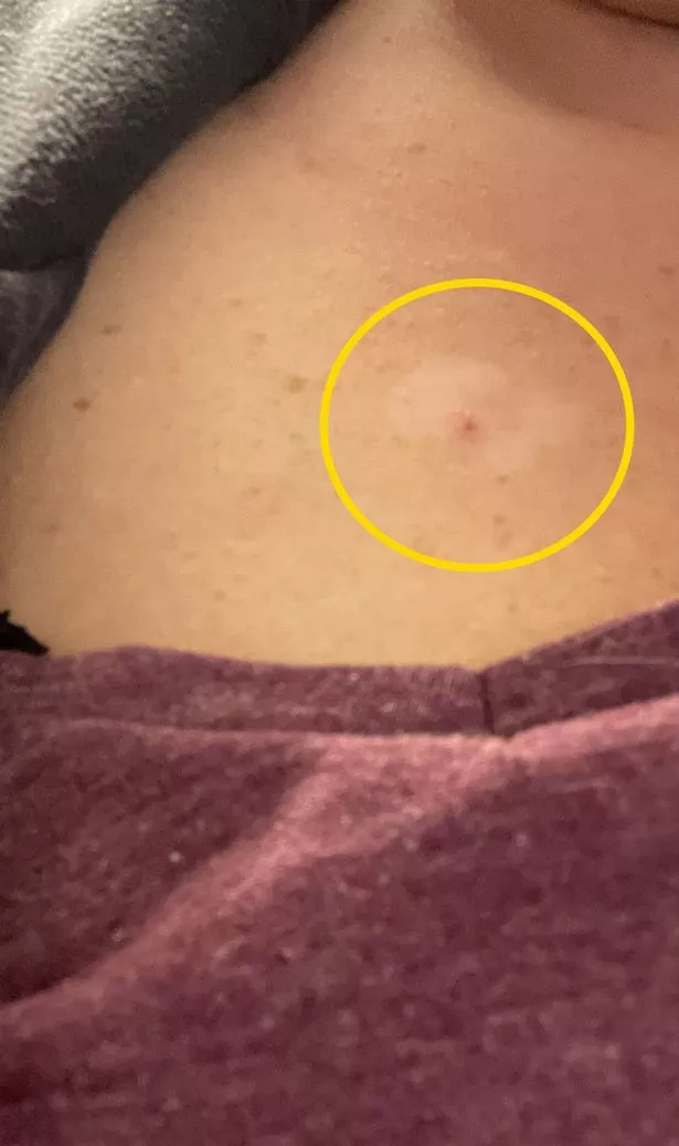 The red spot (Kennedy News and Media)