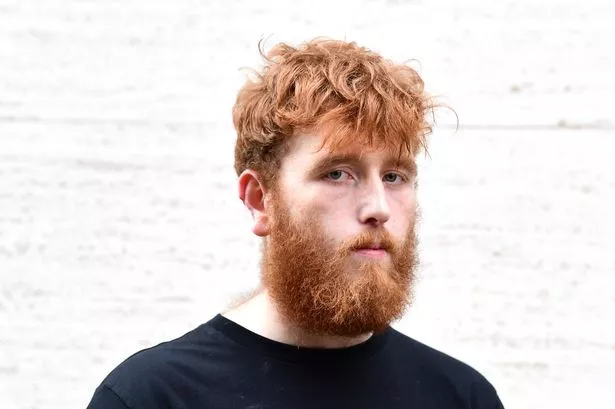 Kit Nolan-Barnes had his ear bitten off outside Shenanigans