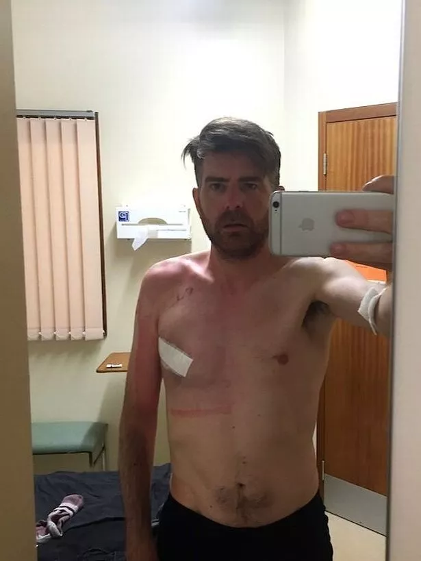 Phil Alderson after surgery.