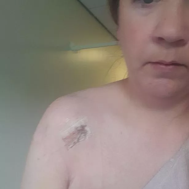 Natalie said the jab was administered it entered the "wrong part" of her left shoulder