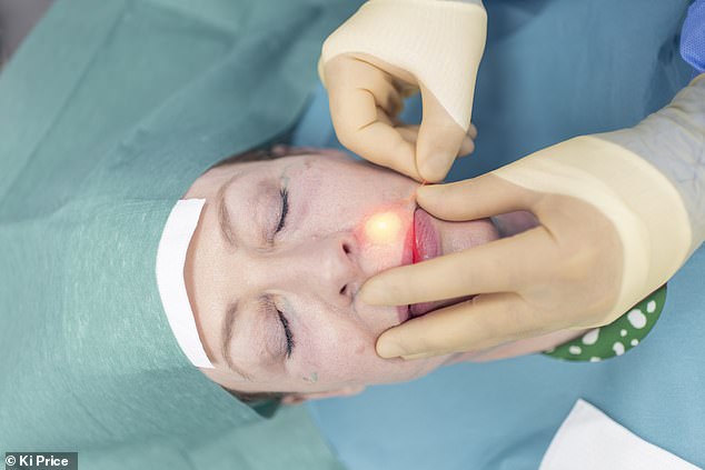Endolift is a non-surgical laser treatment that uses a fine fibre optic wire to deliver energy just beneath the skin, stimulating collagen production for skin tightening and liftin