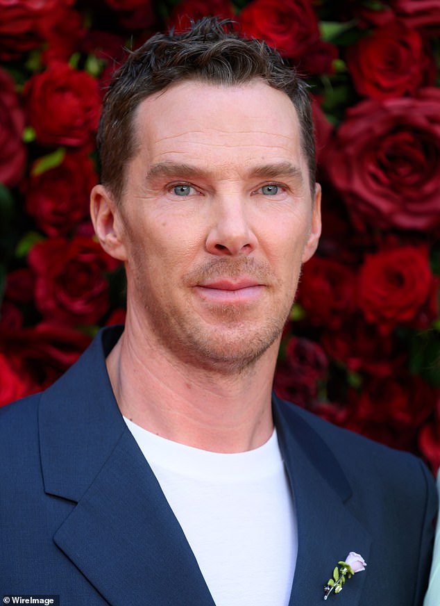 Benedict Cumberbatch has revealed he secretly underwent surgery following a brutal surfing injury (pictured in August)