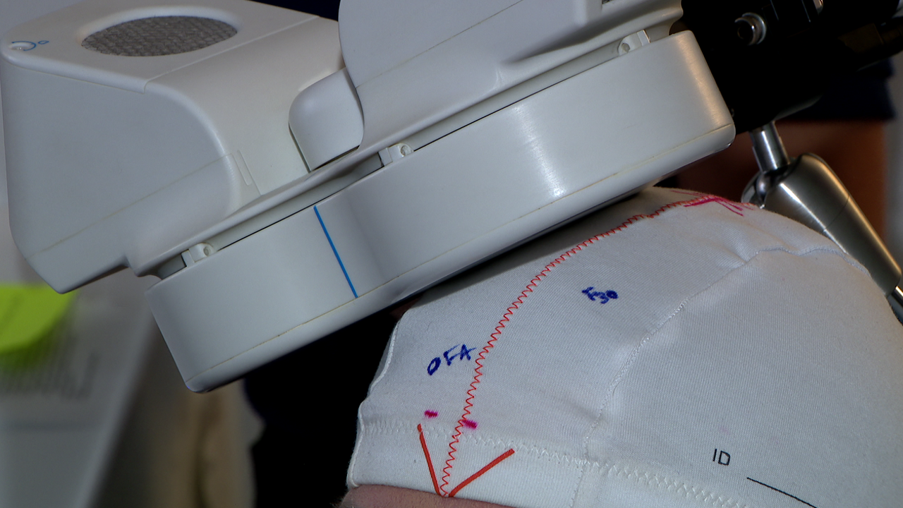 FDA approves new device for teens with severe depression