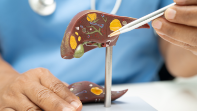 Case study: Understanding Liver Cirrhosis and How to Support Health Naturally