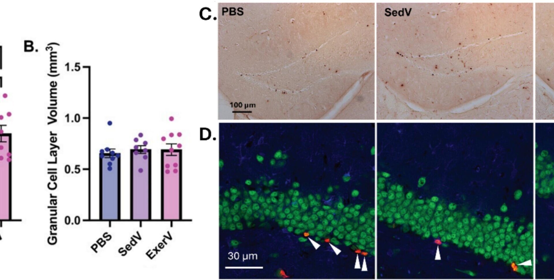Exercise-induced vesicles boost neuron growth when transplanted into sedentary mice