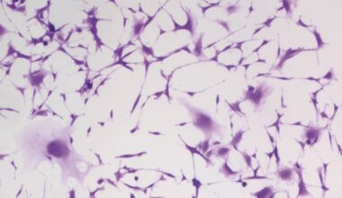 One of the world's oldest blood pressure drugs may also halt aggressive brain tumor growth